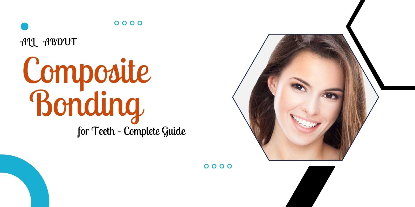 All About Composite Bonding for Teeth – Complete Guide